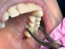 зуби
