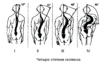 степен