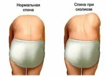 лікування