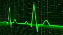 технически Forex търговия