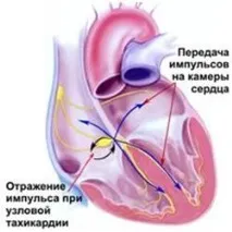 блок блок