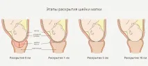 Окситоцин при пологах плюси та мінуси, наслідки для дитини пологах