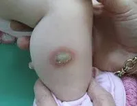 диагностика кожата