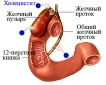 възпаление пътища
