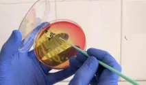 Хламідійний простатит симптоми та лікування хвороби