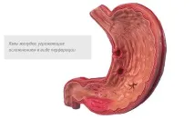 лечение лечение