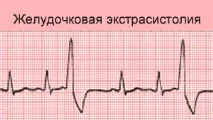 дослідження