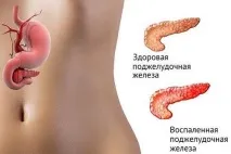 здравословно захарен диабет