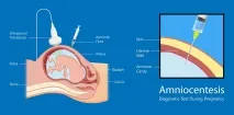 Амніоцентез показання, результати, прогнози амніоцентез