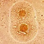 blog Ureaplasma urealyticum