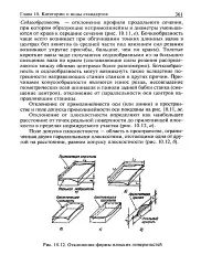 Бочкоподібність - Велика Енциклопедія Нафти та Газа, стаття 3 бочкоподібність