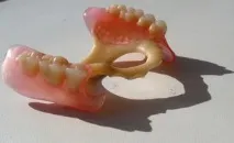 бюгельний