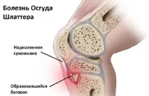 schlatter колянната