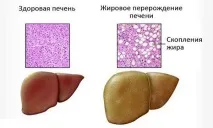 дифузни дифузни