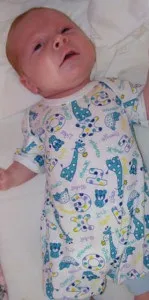 Епілепсія у немовлят причини, симптоми, способи успішного лікування та що робити батькам під час причини