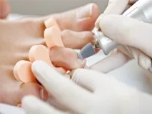 Feetinfo - ВСЕ ПРО ВАШІ НІЖКИ ногах