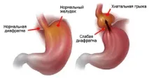 діагностика