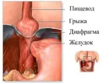 діагностика