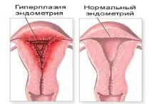 маточна маточна