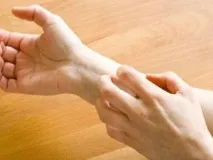 Як лікувати нейродерміт народними засобами Ефективні рецепти для лікування нейродерміту, Народна народними