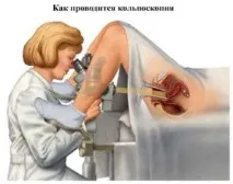 кисти методи