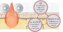 вечна красота