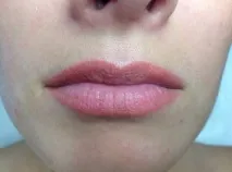 лицето лицето