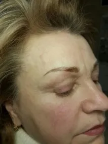 контурен лицето