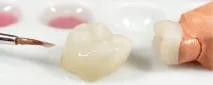 фиксирано зъби
