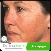 шкіри