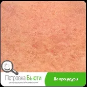 процедура