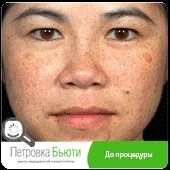 омолодження