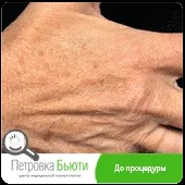 процедура