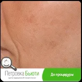 процедура