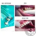 Лікування склеродермії у клініках Москви лікування