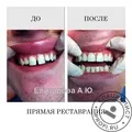 Лікування склеродермії у клініках Москви москви