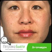 шкіри