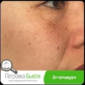 омолодження