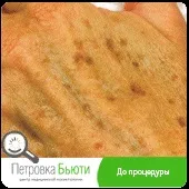 процедура