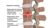 шморл отдел