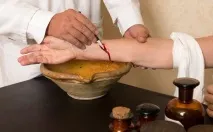 Лікувальне здавання крові (кровопускання) крові