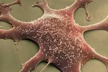 диагноза диагноза