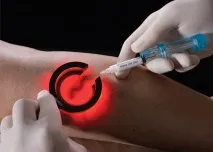 разширени разширени
