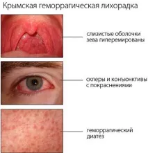 хеморагична треска