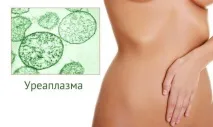 Молочниця без сверблячки, печіння та запаху печіння