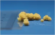 лечение лечение