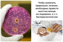Молочниця без сверблячки, печіння та запаху сверблячки