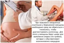 Молочниця без сверблячки, печіння та запаху печіння