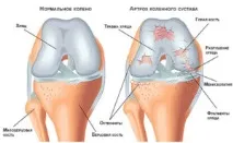 колянната наколенници