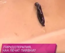 пиявиците пиявиците